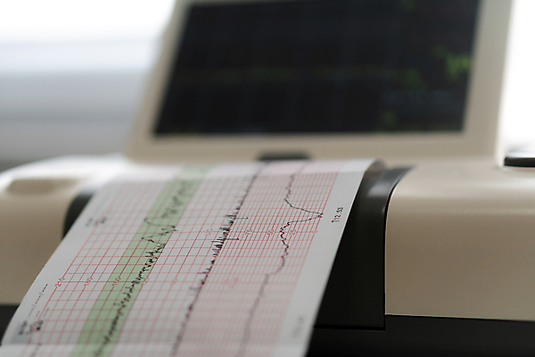 포토 JPG 해외이미지 의료기기 실내 병원 사람없음 아웃포커스 인쇄 심전도검사표 심전도모니터 출력기 출력기기 출력장치 해외포토 의학 촬영기법 내부 장비 파일형식 이미지허브