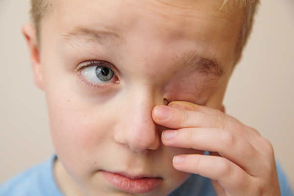 포토 JPG 해외이미지 백인 손 남자 감정 아들 얼굴 어린이 스트레스 건강 피곤 한명 사람 동양인 소년 청년 고통 슬픔 흰색 표현 아기 작음 인도인 고민 두통 걸음마 고립 이마 천진난만 편두통 해외포토 서양인 외국인 1 컬러 컨셉 가족 모션 인종 성인 신체부위 질병 크기 파일형식 이미지허브