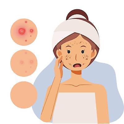 EPS 해외이미지 클립아트 캐릭터 여자 얼굴 일러스트 건강 사람 표현 플랫 만화 피부 걱정 피부관리 충격 문제 단계 고립 트러블 전후 못생김 해외일러스트 일러캐릭터 감정 신체부위 뷰티 비교 파일형식 벡터 이미지허브