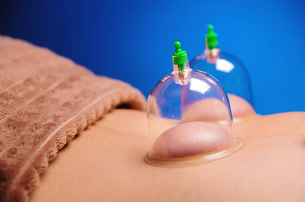 포토 JPG 해외이미지 건강 신체부위 치료 한의학 부항 부항단지 해외포토 의학 사람 파일형식 이미지허브