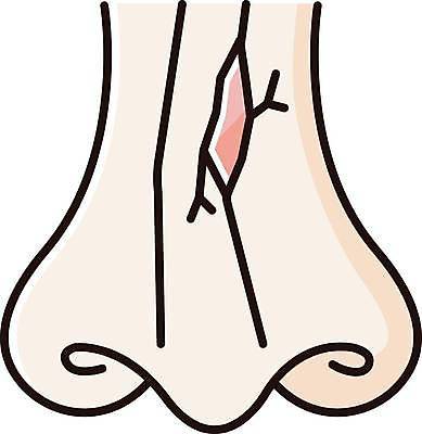 EPS 해외이미지 클립아트 디자인 얼굴 선 컨셉 신체 일러스트 해부 뼈 골격 건강 병원 사람 치료 픽토그램 약 웹 고통 긴급 균열 플랫 상처 만화 심볼 코 심플 윤곽 고립 골절 깨짐 얇은 엘리먼트 연골 활자 해외일러스트 감정 인터넷 의학 모션 신체부위 활자판 파일형식 벡터 이미지허브