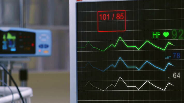 선 해부 프레임 기술 건강 병원 사람 사람없음 약 스크린 모니터 자료 기계 방 장비 환자 기구 하트 긴급 혈액 맥박 속도 감시 돌봄 바이탈 심전도 압력 MOV 해외동영상 클립영상 모양 의학 모션 컴퓨터 동영상 파일형식