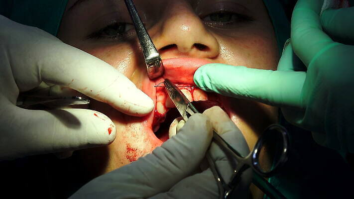 직업 남자 부분 건강 치과 병원 사람 치료 약 방 환자 의사 도구 긴급 입 구멍 수술 닫기 치아 상처 플라스틱 사건 치과의사 뿌리 운하 외과 돌봄 바늘땀 위생관리 잇몸 작동 살균 실종 4K MOV 해외동영상 클립영상 신체 의학 모션 재질 관리 신체부위 의료진 소화기관 동영상 파일형식