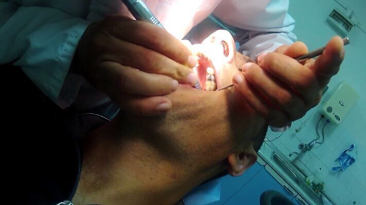 백인 직업 여자 산업 어린이 건강 치과 병원 사람 치료 약 장비 환자 의사 기구 오픈 입 치아 무서움 부식 치과의사 방문 순서 돌봄 명패 송곳 위생관리 잇몸 1인칭시점 HD 구강학 MOV 해외동영상 클립영상 서양인 시선 감정 신체 의학 모션 관리 신체부위 의료진 소화기관 동영상 파일형식