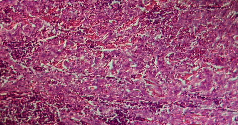 과학 이동 패턴 세포 사람없음 빨간색 파란색 약 시험 성장 조직 확대 질병 종양 지원 4K 현미경관찰 MOV 해외동영상 클립영상 교육 컬러 컨셉 무늬 의학 관찰 동영상 파일형식
