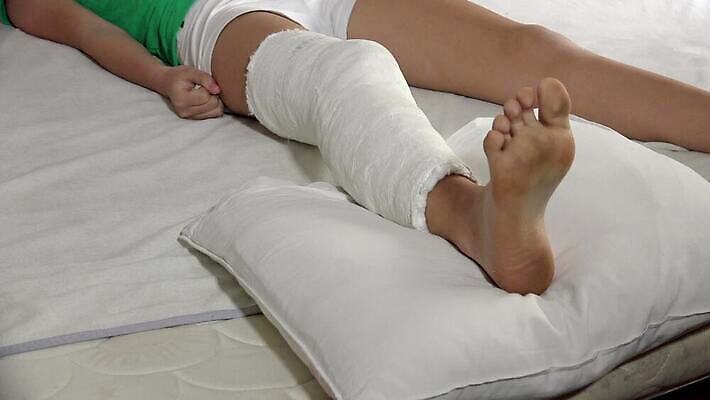 뼈 건강 병원 사람 약 손상 고통 환자 의사 질병 상처 사건 붕대 무릎 외과 발목 보험 골절 깨짐 돌봄 석고 양발 정형외과 4K HD MP4 해외동영상 클립영상 감정 컨셉 의학 모션 발 신체부위 의료진 동영상 파일형식