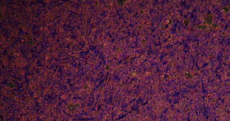 과학 이동 패턴 세포 사람없음 빨간색 파란색 약 시험 성장 조직 확대 지원 4K 현미경관찰 MOV 해외동영상 클립영상 교육 컬러 컨셉 무늬 의학 관찰 동영상 파일형식