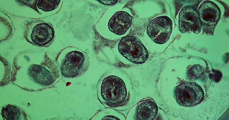 과학 이동 세포 사람없음 빨간색 파란색 약 시험 성장 조직 확대 질병 간 지원 4K 현미경관찰 MOV 해외동영상 클립영상 교육 컬러 컨셉 의학 관찰 장기_의학 동영상 파일형식