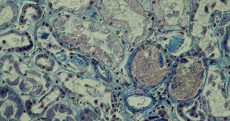 과학 이동 패턴 세포 사람없음 빨간색 파란색 약 시험 성장 조직 신장 확대 질병 감염 지원 4K 현미경관찰 MOV 해외동영상 클립영상 교육 컬러 컨셉 무늬 의학 관찰 비뇨기관 동영상 파일형식