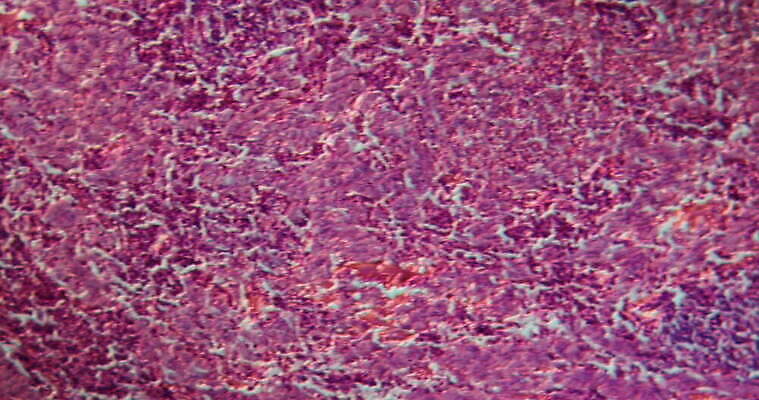 해부 세포 건강 병원 사람없음 약 진료 고통 시험 의사 기구 조직 확대 질병 돌봄 종양 4K MOV 해외동영상 클립영상 교육 감정 의학 모션 의료진 동영상 파일형식