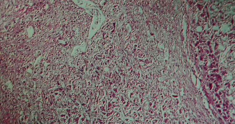 과학 이동 패턴 세포 사람없음 빨간색 파란색 약 시험 성장 조직 확대 질병 지원 4K 현미경관찰 MOV 해외동영상 클립영상 교육 컬러 컨셉 무늬 의학 관찰 동영상 파일형식