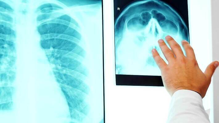 백인 직업 손 응시 남자 청진기 모션 골격 엑스레이 건강 병원 실험 한명 치료 컴퓨터 약 머리 모니터 진료 의사 광선 흰색 실험실 허파 닫기 필름 뇌 새장 외과 갈비뼈 턱 궤 돌봄 방사선 4K MOV 해외동영상 클립영상 서양인 1 시선 컬러 의학 의료기기 뼈 사람 신체부위 전자제품 의료진 호흡기관 동영상 케이지 파일형식