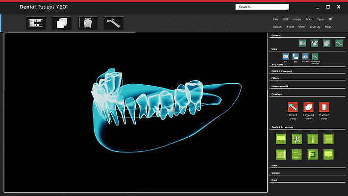 모델 직업 디자인 해부 뼈 골격 기술 엑스레이 건강 파노라마 치과 사람없음 그래픽 약 3D 우주 디지털 광선 입 치아 필름 치과의사 뿌리 턱 방사선 소프트웨어 스캐너 스캔 인터페이스 치통 프로그램 4K 구강학 MOV 해외동영상 클립영상 의학 촬영기법 병원 신체부위 의사 소화기관 질병 디지털합성 동영상 파일형식