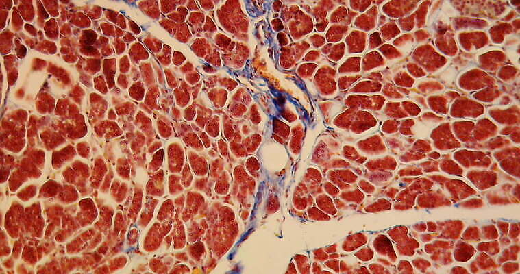해부 세포 건강 병원 사람없음 약 진료 고통 시험 의사 기구 조직 확대 질병 간 감염 췌장 돌봄 4K MOV 해외동영상 클립영상 교육 감정 의학 모션 의료진 장기_의학 동영상 파일형식