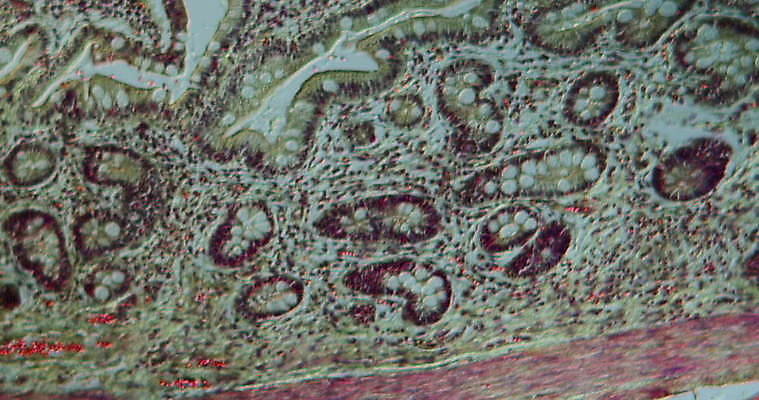 과학 이동 패턴 세포 사람없음 빨간색 파란색 약 시험 성장 조직 확대 질병 지원 4K 현미경관찰 MOV 해외동영상 클립영상 교육 컬러 컨셉 무늬 의학 관찰 동영상 파일형식
