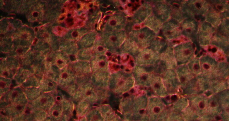 과학 이동 패턴 세포 사람없음 빨간색 파란색 약 시험 성장 조직 확대 간 지원 4K 현미경관찰 MOV 해외동영상 클립영상 교육 컬러 컨셉 무늬 의학 관찰 장기_의학 동영상 파일형식