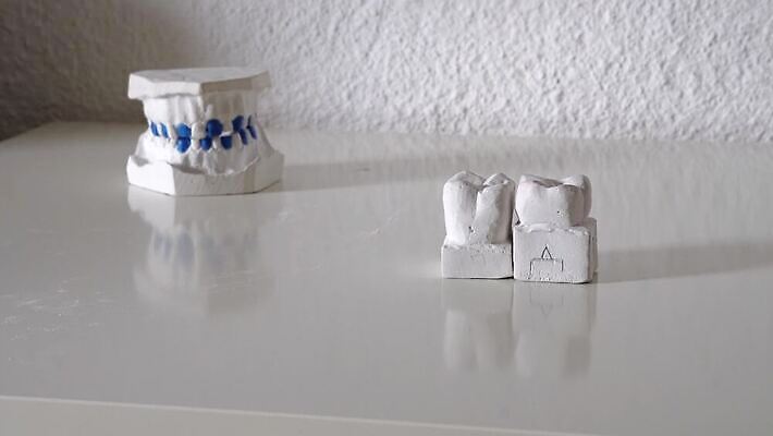 모델 직업 여자 백그라운드 왕관 건강 치과 병원 미소 사람 사람없음 치료 사무실 약 장비 의사 흰색 기구 공구 잡기 입 실험실 치아 청소 치과의사 외과 턱 틀니 고립 돌봄 보철 예시 위생관리 인공 잇몸 치아교정 4K MP4 해외동영상 클립영상 컬러 신체 비즈니스 의학 모션 표정 실험 관리 신체부위 의료진 도구 소화기관 교정 동영상 파일형식