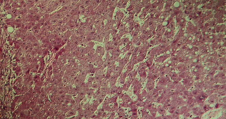과학 이동 패턴 세포 사람없음 빨간색 파란색 약 시험 성장 조직 확대 질병 지원 4K 현미경관찰 MOV 해외동영상 클립영상 교육 컬러 컨셉 무늬 의학 관찰 동영상 파일형식