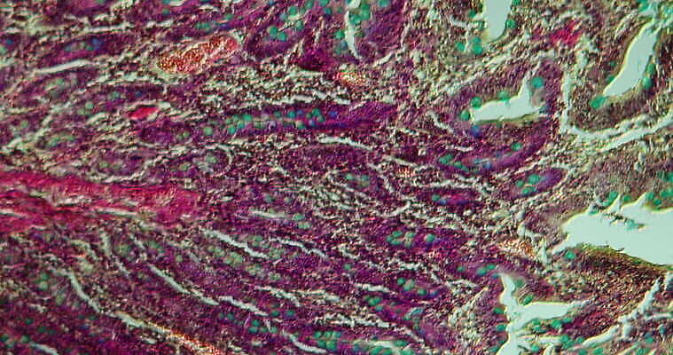 과학 이동 패턴 세포 사람없음 빨간색 파란색 약 시험 성장 조직 확대 질병 지원 4K 현미경관찰 MOV 해외동영상 클립영상 교육 컬러 컨셉 무늬 의학 관찰 동영상 파일형식