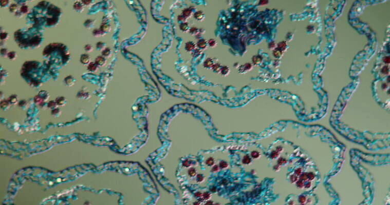 식물 꽃 과학 이동 패턴 세포 사람없음 빨간색 초록색 파란색 시험 성장 벚꽃 조직 횡단보도 확대 데이지 지원 4K 현미경관찰 MOV 해외동영상 클립영상 교육 컬러 컨셉 무늬 관찰 보행로 동영상 파일형식