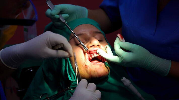 직업 손 여자 부분 건강 치과 병원 사람 치료 사무실 약 방 환자 의사 도구 긴급 입 구멍 수술 닫기 치아 상처 플라스틱 사건 치과의사 뿌리 운하 외과 돌봄 바늘땀 잇몸 작동 살균 실종 4K MOV 해외동영상 클립영상 신체 비즈니스 의학 모션 재질 신체부위 의료진 소화기관 동영상 파일형식