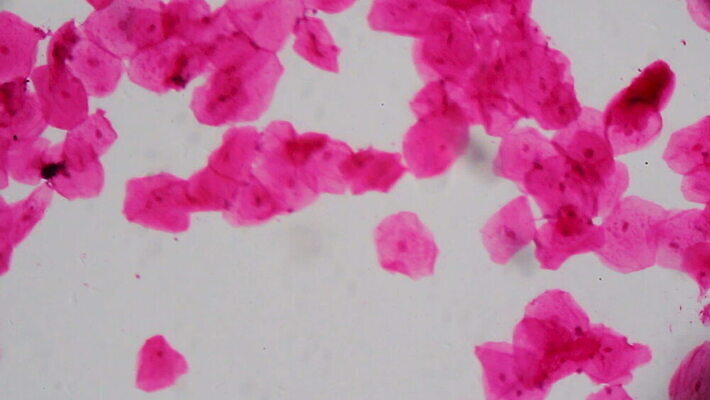 디자인 과학 백그라운드 패턴 해부 표면 추상 생물 세포 건강 현미경 미술 사람 사람없음 그래픽 약 보라색 페인트 입 조직 그룹 혈액 실험실 피부 질감 생물학 시스템 암 그런지 종양 MOV 해외동영상 클립영상 교육 컬러 무늬 의학 문화예술 실험기구 실험 신체부위 질병 동영상 파일형식