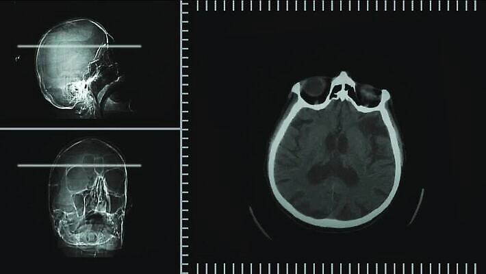 조각 신체 엑스레이 건강 병원 사람없음 치료 컴퓨터 약 머리 건강관리 질병 컨테이너 뇌 동맥 치료제 해골모형 MOV 해외동영상 클립영상 산업 의학 관리 신체부위 전자제품 모형 혈관 동영상 파일형식