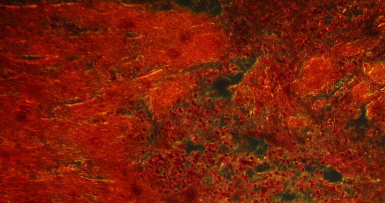 과학 패턴 세포 사람없음 빨간색 파란색 시험 성장 조직 질병 지원 4K 현미경관찰 MOV 해외동영상 클립영상 교육 컬러 무늬 의학 관찰 동영상 파일형식