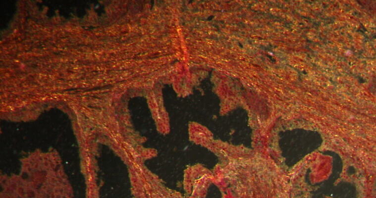 과학 패턴 세포 사람없음 빨간색 파란색 시험 성장 조직 질병 지원 4K 현미경관찰 MOV 해외동영상 클립영상 교육 컬러 무늬 의학 관찰 동영상 파일형식