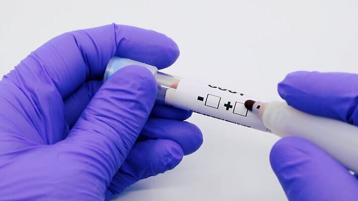 과학 실험 사람없음 치료 라벨 견본 건강관리 미국 중국 장비 의사 실험실 바이러스 결과 질병 컨테이너 수집 분석 시험관 긍정 감염 전염 튜브 박테리아 전염병 사스 코로나바이러스 4K 유체 MP4 해외동영상 클립영상 산업 아시아 컨셉 북아메리카 의학 프레임 건강 실험기구 관리 의료진 동영상 파일형식
