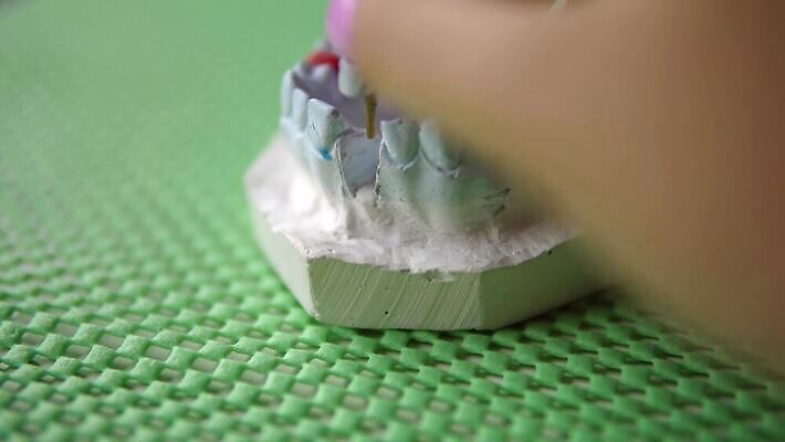 모델 직업 왕관 건강 치과 병원 실험 미소 치료 사무실 약 장비 의사 흰색 도자기 입 실험실 치아 청소 치과의사 외과 턱 틀니 돌봄 백자 보철 위생관리 치아교정 합판 4K MP4 해외동영상 클립영상 컬러 비즈니스 의학 모션 표정 관리 신체부위 의료진 소화기관 교정 동영상 파일형식