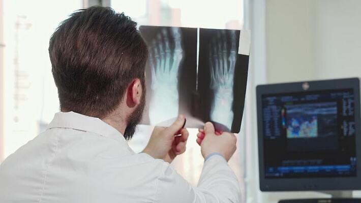 직업 뼈 엑스레이 건강 병원 두명 치료 약 환자 간호사 의사 기술자 실험실 분석 예방 약속 암 보험 방사선 종양 증상 치료사 4K MOV 해외동영상 클립영상 컨셉 의학 실험 사람 의료진 질병 동영상 파일형식