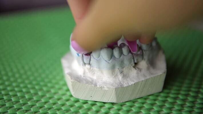 모델 직업 왕관 건강 치과 병원 실험 미소 치료 약 장비 의사 흰색 도자기 입 실험실 치아 청소 치과의사 외과 턱 틀니 돌봄 백자 보철 위생관리 치아교정 합판 4K MP4 해외동영상 클립영상 컬러 의학 모션 표정 관리 신체부위 의료진 소화기관 교정 동영상 파일형식