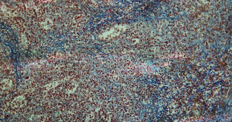 과학 이동 세포 사람없음 빨간색 파란색 약 시험 성장 조직 확대 질병 지라 지원 4K 현미경관찰 MOV 해외동영상 클립영상 교육 컬러 컨셉 의학 관찰 동영상 파일형식