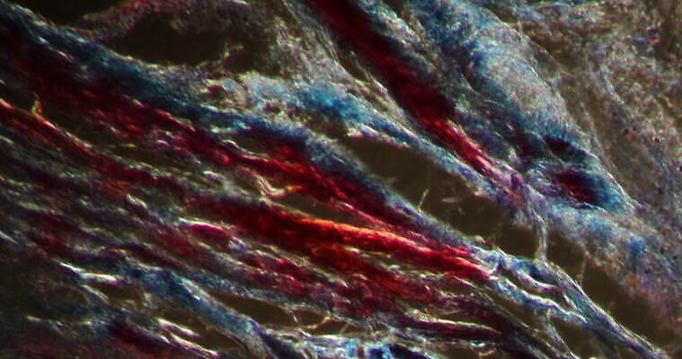 과학 패턴 세포 사람없음 빨간색 파란색 시험 성장 조직 질병 연골 지원 4K 현미경관찰 MOV 해외동영상 클립영상 교육 컬러 무늬 의학 관찰 동영상 파일형식