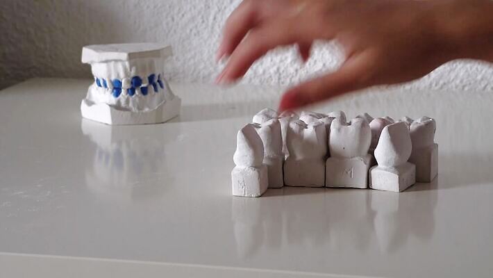 모델 직업 손 백그라운드 왕관 건강 치과 병원 사람 치료 약 3D 장비 의사 흰색 입 실험실 치아 치과의사 외과 턱 틀니 돌봄 백자 보철 썩음 인공 치아교정 4K 구강학 MP4 해외동영상 클립영상 컬러 의학 모션 실험 신체부위 의료진 도자기 소화기관 디지털합성 교정 동영상 파일형식