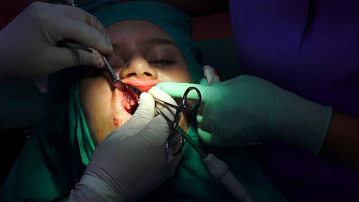 직업 손 왕관 뼈 건강 치과 병원 사람 소년 치료 약 금속 방 장비 과학기술 환자 의사 흰색 오픈 입 수술 치아 자르기 입술 부식 치과의사 뿌리 외과 턱 돌봄 바늘땀 보철 썩음 위생관리 잇몸 살균 4K MOV 해외동영상 클립영상 남자 어린이 컬러 신체 의학 모션 재질 기술 관리 신체부위 의료진 소화기관 동영상 파일형식