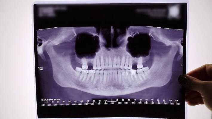 직업 과학 해부 골격 엑스레이 건강 파노라마 치과 병원 사람없음 약 기계 장비 의사 광선 관찰 입 치아 X 필름 그림 치과의사 문서 외과 턱 돌봄 방사선 스캐너 치아교정 구강학 MOV 해외동영상 클립영상 알파벳 의학 모션 촬영기법 신체부위 의료진 소화기관 교정 동영상 파일형식