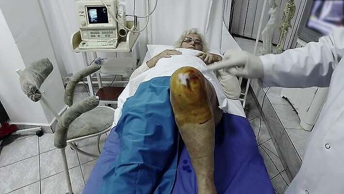 손 장갑 텍스트 해부 유리병 건강 주사기 한명 사람 치료 알약 약 3D 고통 수술 선택 맥박 질병 상처 엉덩이 손목 어깨 관절염 무릎 골다공증 주사약 테라피 발목 돌봄 블러 예방접종 팔꿈치 4K MP4 해외동영상 클립영상 1 잡화 감정 컨셉 의학 의료기기 모션 발 병_용기 신체부위 뷰티 디지털합성 팔 동영상 접종 파일형식