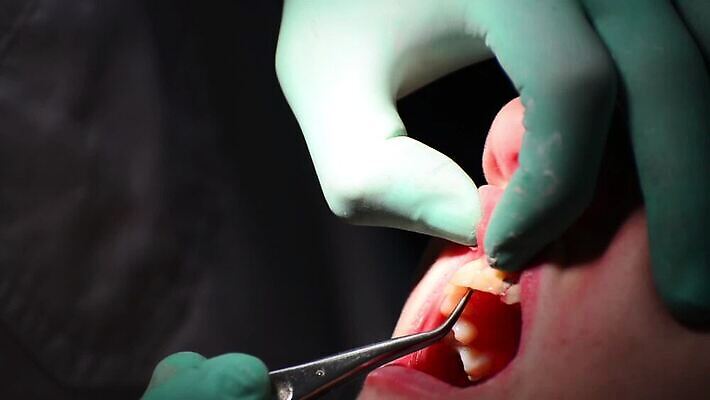 백인 직업 여자 산업 어린이 건강 치과 병원 사람 치료 약 장비 환자 의사 기구 오픈 입 닫기 치아 무서움 부식 치과의사 방문 순서 돌봄 명패 송곳 위생관리 잇몸 HD 구강학 MOV 해외동영상 클립영상 서양인 감정 신체 의학 모션 관리 신체부위 의료진 소화기관 동영상 파일형식