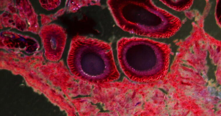 동물 과학 이동 세포 사람없음 빨간색 약 시험 성장 조직 확대 거미 지원 4K 현미경관찰 MOV 해외동영상 클립영상 교육 컬러 곤충 컨셉 의학 관찰 동영상 파일형식