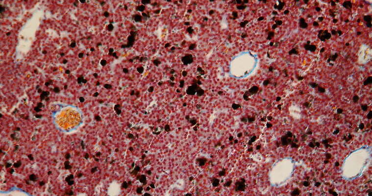 과학 이동 세포 개구리 사람없음 빨간색 파란색 약 시험 성장 조직 확대 쥐 간 지원 4K 현미경관찰 MOV 해외동영상 클립영상 교육 컬러 컨셉 의학 양서류 관찰 장기_의학 설치류 동영상 파일형식