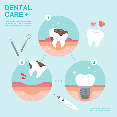 하늘색 일러스트 주사기 사람없음 치료 하트 치아 치과진료 발치 어금니 임플란트 잇몸 충치 치아건강 구강거울 국내일러스트 AI파일 모양 신체 의학 의료기기 건강 치과 파란색 진료 소화기관 질병 치과용품 파일형식 벡터