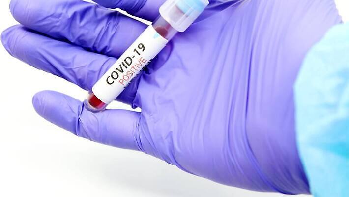 유럽 과학 실험 사람없음 치료 라벨 견본 건강관리 미국 장비 의사 실험실 바이러스 결과 질병 컨테이너 수집 분석 시험관 긍정 전염 유럽연합 전염병 사스 코로나바이러스 4K 유체 MP4 해외동영상 클립영상 나라 산업 컨셉 북아메리카 의학 프레임 건강 실험기구 관리 의료진 감염 동영상 파일형식