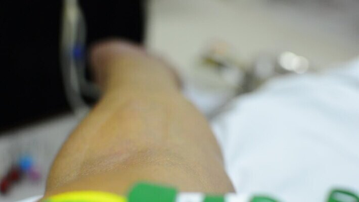 손 신체 의료기기 건강 병원 눕기 약 환자 간호사 신선 잡기 봉사 센터 혈액 실험실 질병 주기 팔 암 외과 타입 정맥 기부 돌봄 삽입 에이즈 인수 적자 헬프 MOV 해외동영상 클립영상 의학 모션 실험 신체부위 의료진 도움 혈관 동영상 파일형식