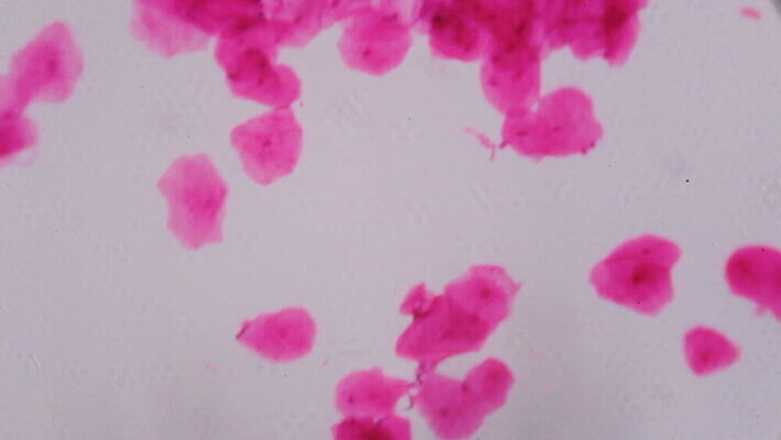 디자인 과학 백그라운드 패턴 해부 표면 추상 생물 세포 건강 현미경 미술 사람 사람없음 그래픽 약 보라색 페인트 입 조직 그룹 혈액 실험실 피부 질감 생물학 시스템 암 그런지 종양 MOV 해외동영상 클립영상 교육 컬러 무늬 의학 문화예술 실험기구 실험 신체부위 질병 동영상 파일형식