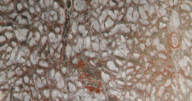 과학 이동 패턴 세포 사람없음 빨간색 파란색 약 시험 성장 하트 조직 확대 질병 파편 지원 4K 현미경관찰 MOV 해외동영상 클립영상 모양 교육 컬러 컨셉 무늬 의학 관찰 동영상 파일형식