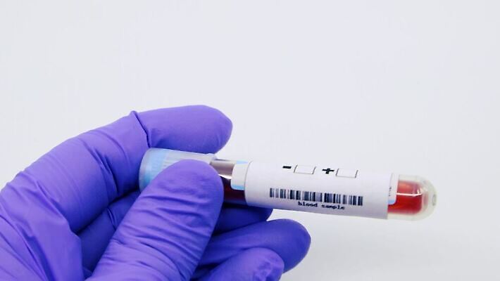 과학 실험 사람없음 치료 라벨 견본 건강관리 미국 중국 장비 의사 실험실 바이러스 결과 질병 컨테이너 수집 분석 시험관 긍정 감염 전염 튜브 박테리아 전염병 사스 코로나바이러스 4K 유체 MP4 해외동영상 클립영상 산업 아시아 컨셉 북아메리카 의학 프레임 건강 실험기구 관리 의료진 동영상 파일형식