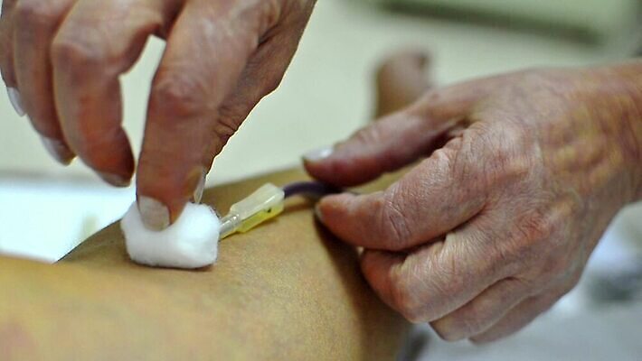 여자 장갑 병원 약 건강관리 장비 환자 간호사 의사 도움 혈액 실험실 보호 질병 주기 팔 암 외과 에이즈 위생관리 MOV 해외동영상 클립영상 잡화 컨셉 의학 모션 건강 실험 관리 사람 신체부위 의료진 동영상 파일형식