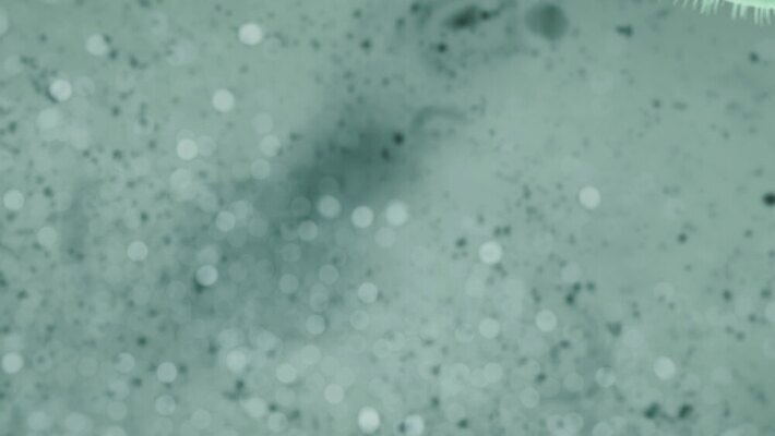 과학 미래 세포 엑스레이 나선형 건강 사람 사람없음 치료 약 디지털 망 혈액 진화 바이러스 질병 생명공학 생물학 회전 감염 미생물 염색체 암 물리학 복제 엘리먼트 유전 폴리곤 4K MP4 해외동영상 클립영상 교육 컨셉 무늬 의학 생물 소방 동영상 물리 파일형식